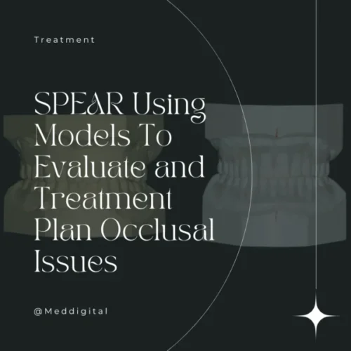 SPEAR Using Models To Evaluate and Treatment Plan Occlusal Issues SPEAR Using Models To Evaluate and Treatment Plan Occlusal Issues – Frank Spear