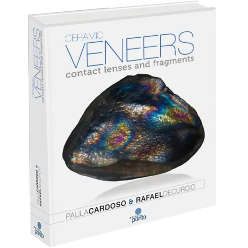Ceramic veneers contact lenses and fragments Ceramic veneers: contact lenses and fragments