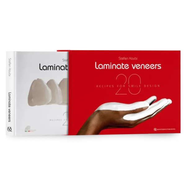 Laminate Veneers 20 Recipes for Smile Design Laminate Veneers: 20 Recipes for Smile Design