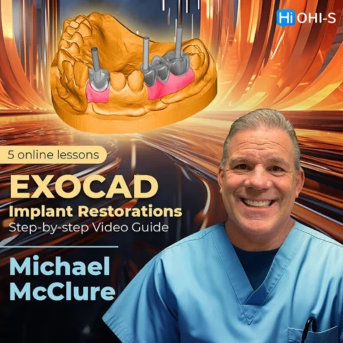OHI-S EXOCAD Implant Restorations Step-by-step Video Guide OHI-S EXOCAD Implant Restorations: Step-by-step Video Guide