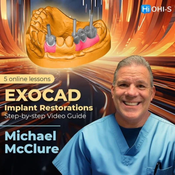 OHI-S EXOCAD Implant Restorations: Step-by-step Video Guide