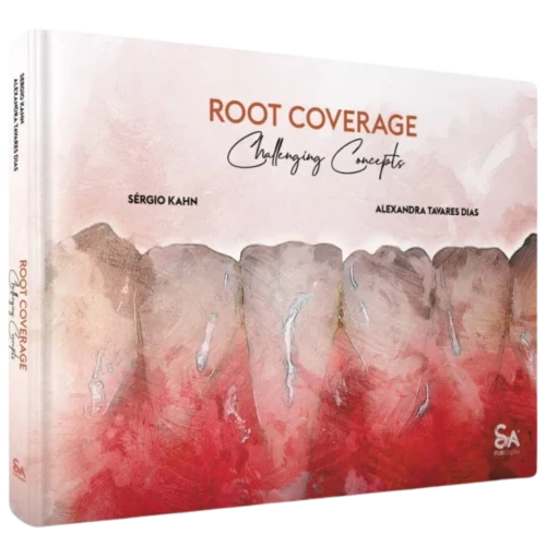Root Coverage – Challenging Concepts Root Coverage – Challenging Concepts