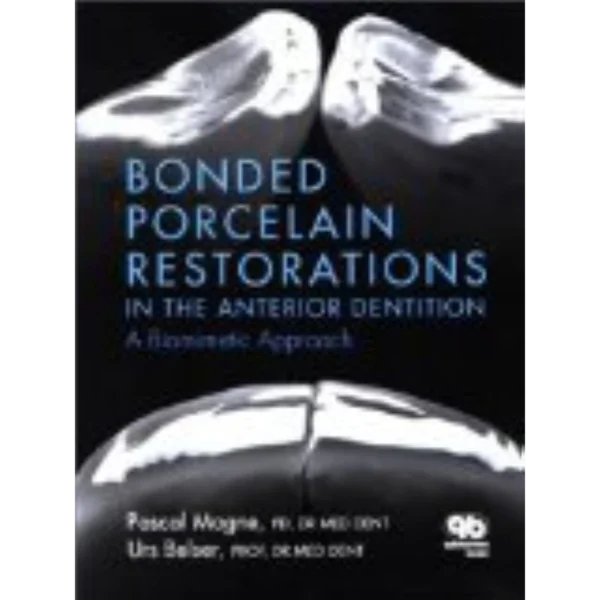 Bonded Porcelain Restorations in the Anterior Dentition