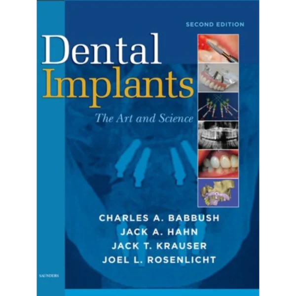 Dental Implants: The Art and Science