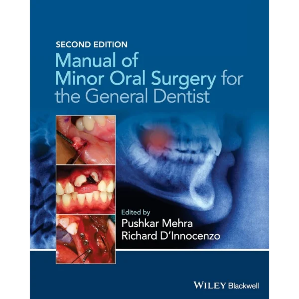Manual of Minor Oral Surgery for the General Dentist Manual of Minor Oral Surgery for the General Dentist