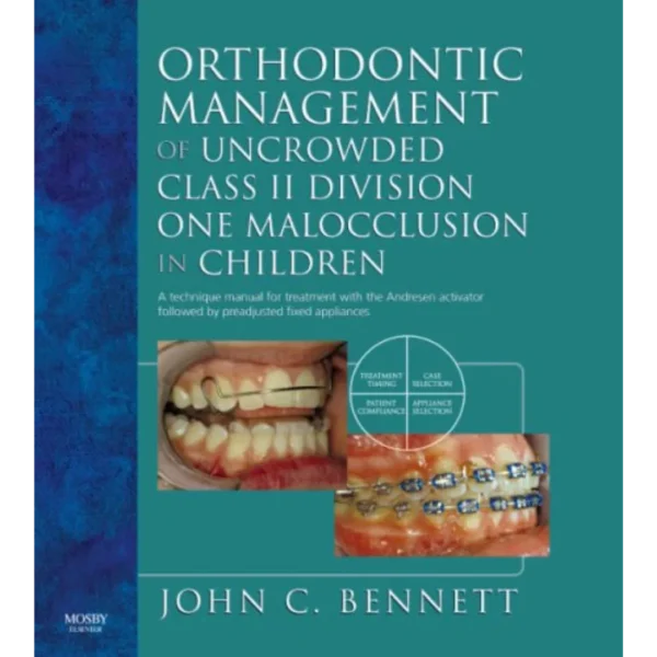 Orthodontic Management of Uncrowded Class II Division One Malocclusion in Children Orthodontic Management of Uncrowded Class II Division One Malocclusion in Children