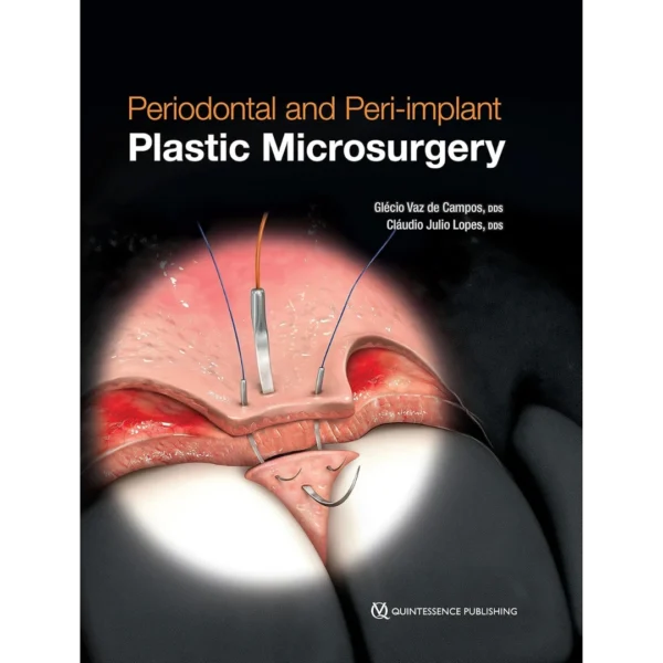 Periodontal and Peri-implant Plastic Microsurgery Periodontal and Peri-implant Plastic Microsurgery: Minimally Invasive Techniques with Maximum Precision