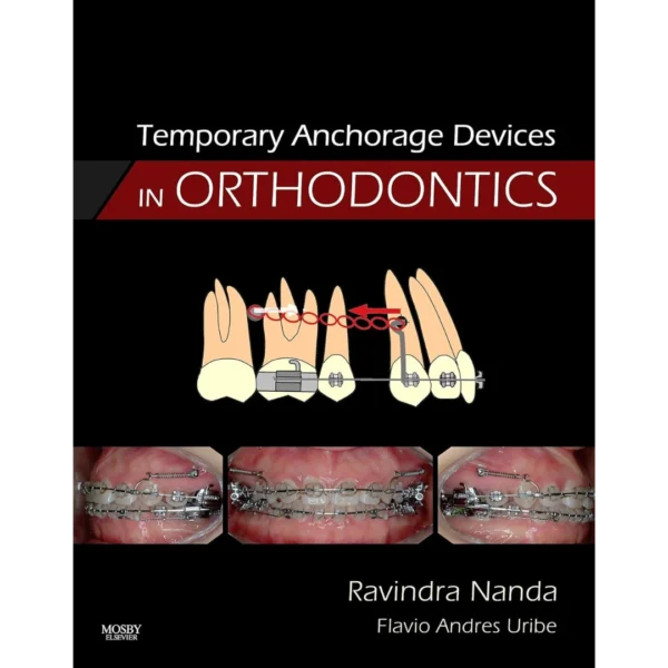 Temporary Anchorage Devices in Orthodontics Temporary Anchorage Devices in Orthodontics