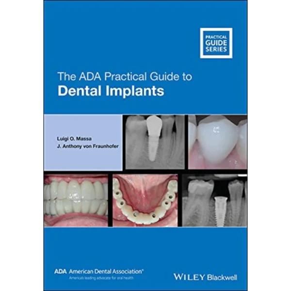 The ADA Practical Guide to Dental Implants The ADA Practical Guide to Dental Implants