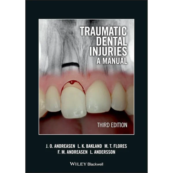 Traumatic Dental Injuries