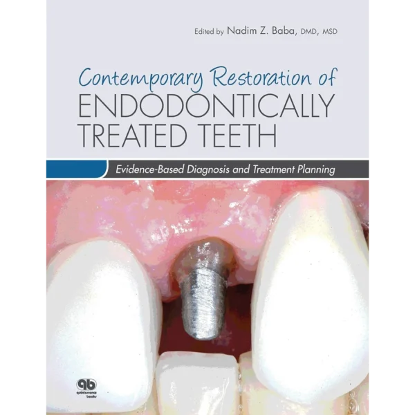 Contemporary Restoration of Endodontically Treated Teeth