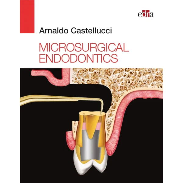 Microsurgical Endodontics Microsurgical Endodontics