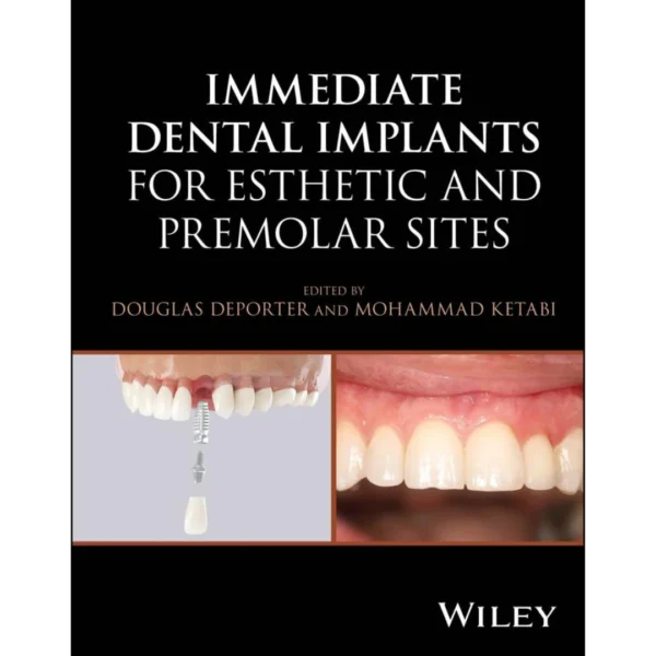 Immediate Dental Implants for Esthetic and Premolar Sites Immediate Dental Implants for Esthetic and Premolar Sites
