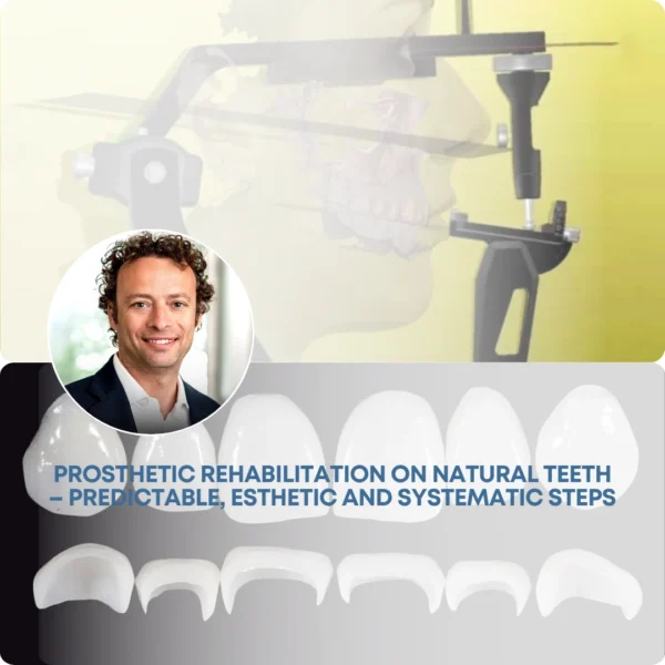 gIDEdental Prosthetic Rehabilitation on Natural Teeth Predictable, Esthetic and Systematic Steps gIDEdental Prosthetic Rehabilitation on Natural Teeth: Predictable, Esthetic and Systematic Steps