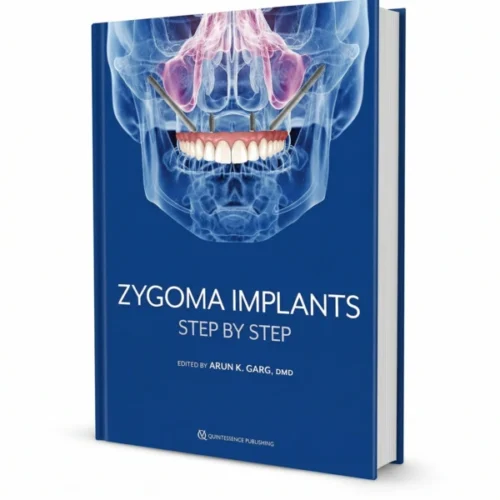 Zygoma Implants: Step by Step