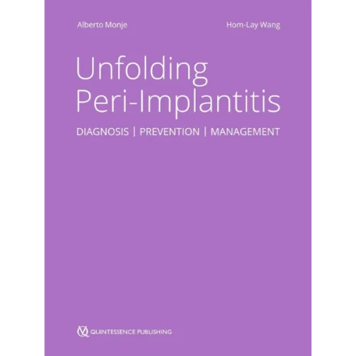 Unfolding Peri-Implantitis Unfolding Peri-Implantitis: Diagnosis | Prevention | Management